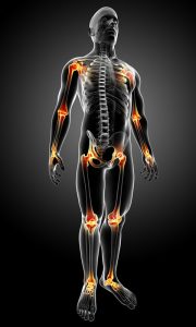 joint pain arthritis picture